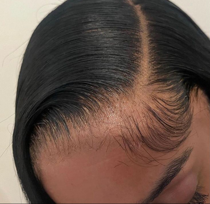 Glueless Wig